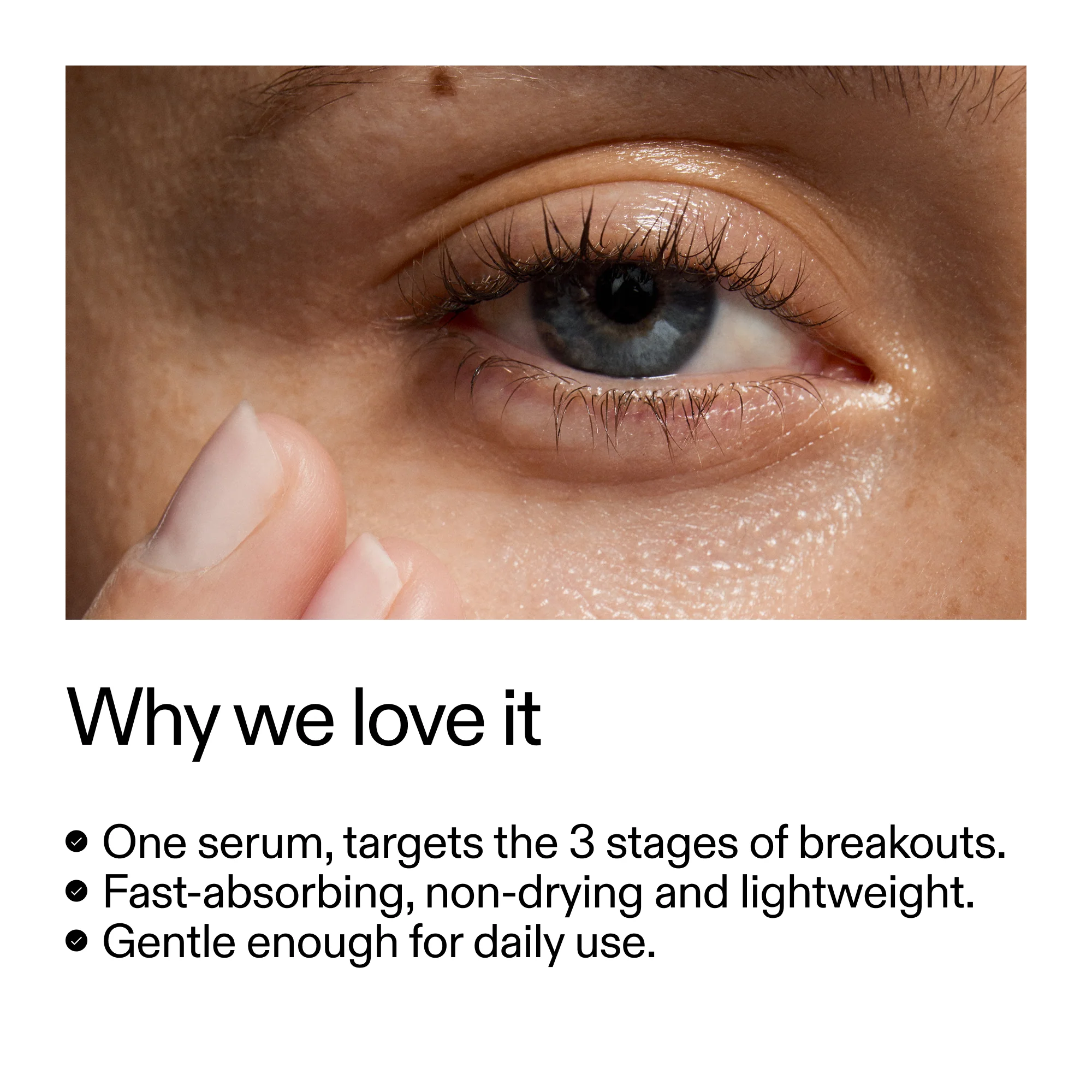 360° Skin Clearing Serum Duo - Image 4