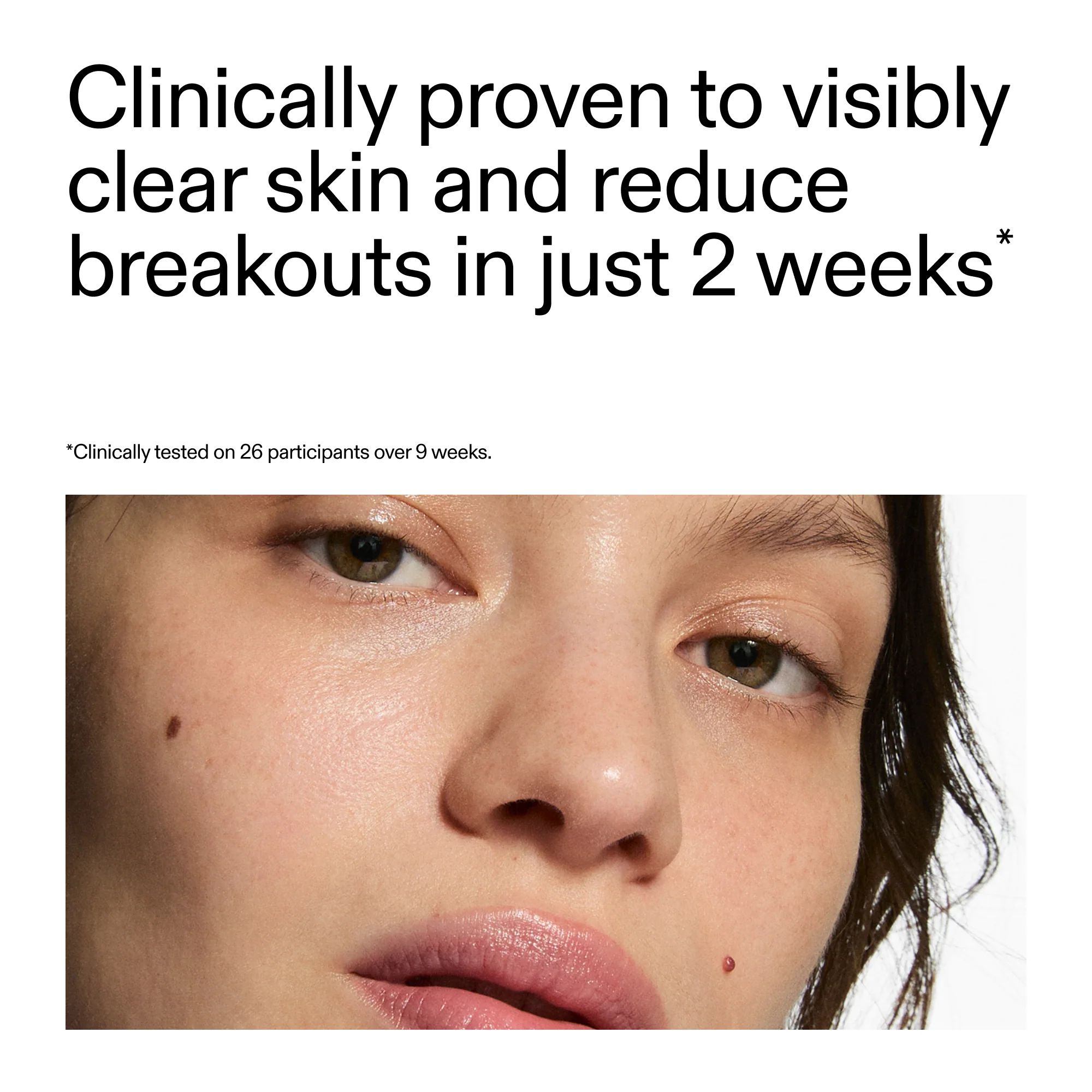 360° Skin Clearing Serum Duo - Image 5