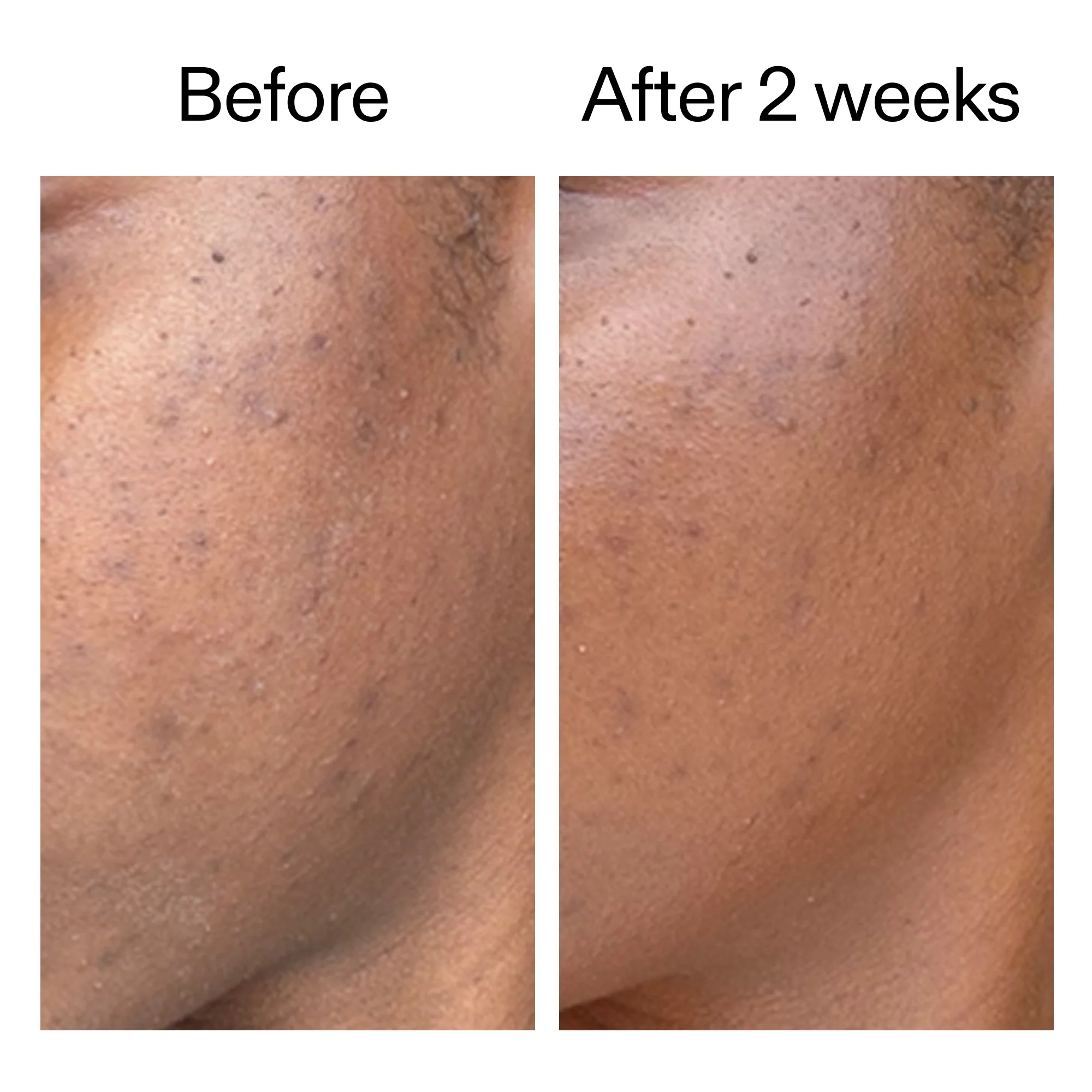 360° Skin Clearing Serum Duo - Image 6