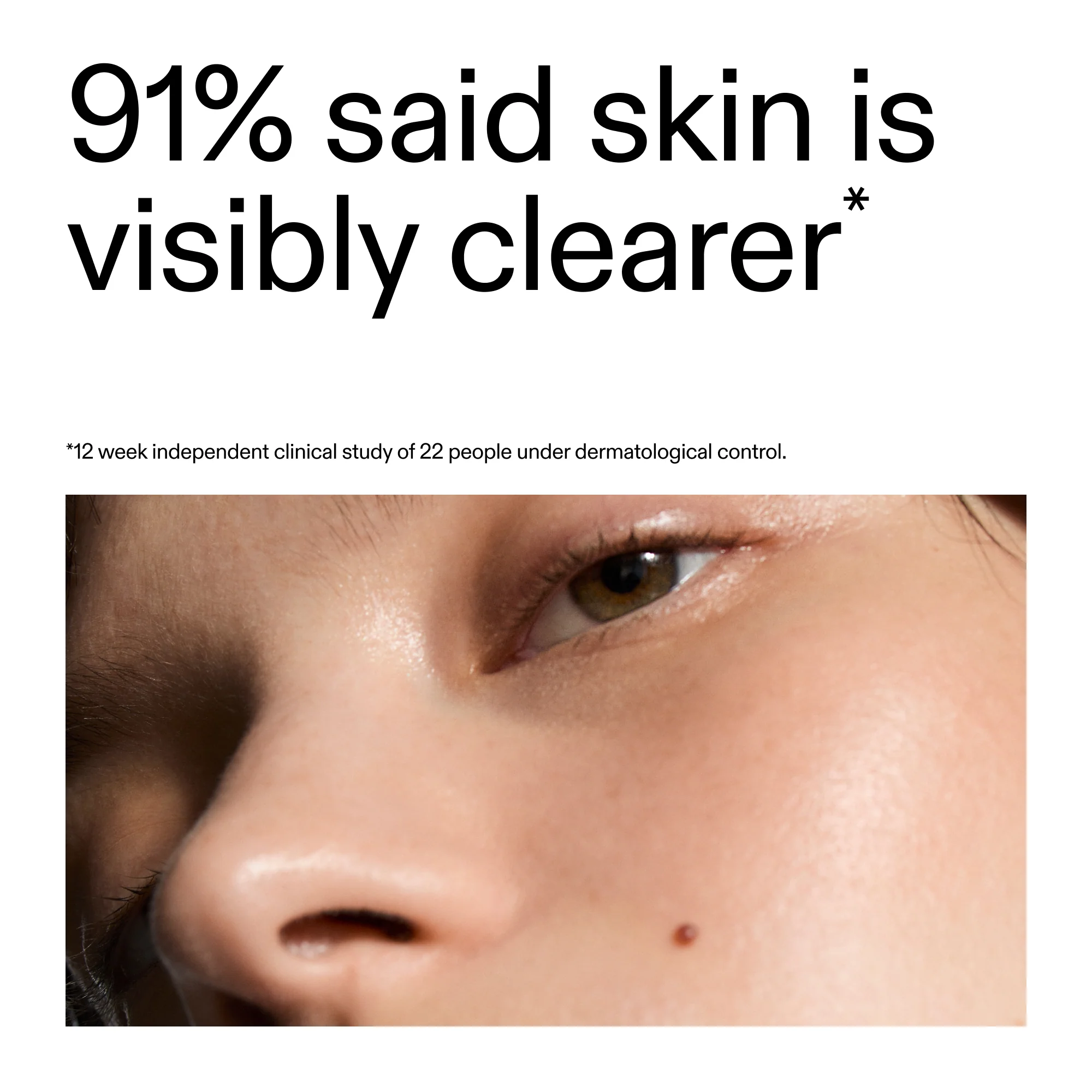 Blemish Clearing Moisturizer with 2% Novoretin - Image 10