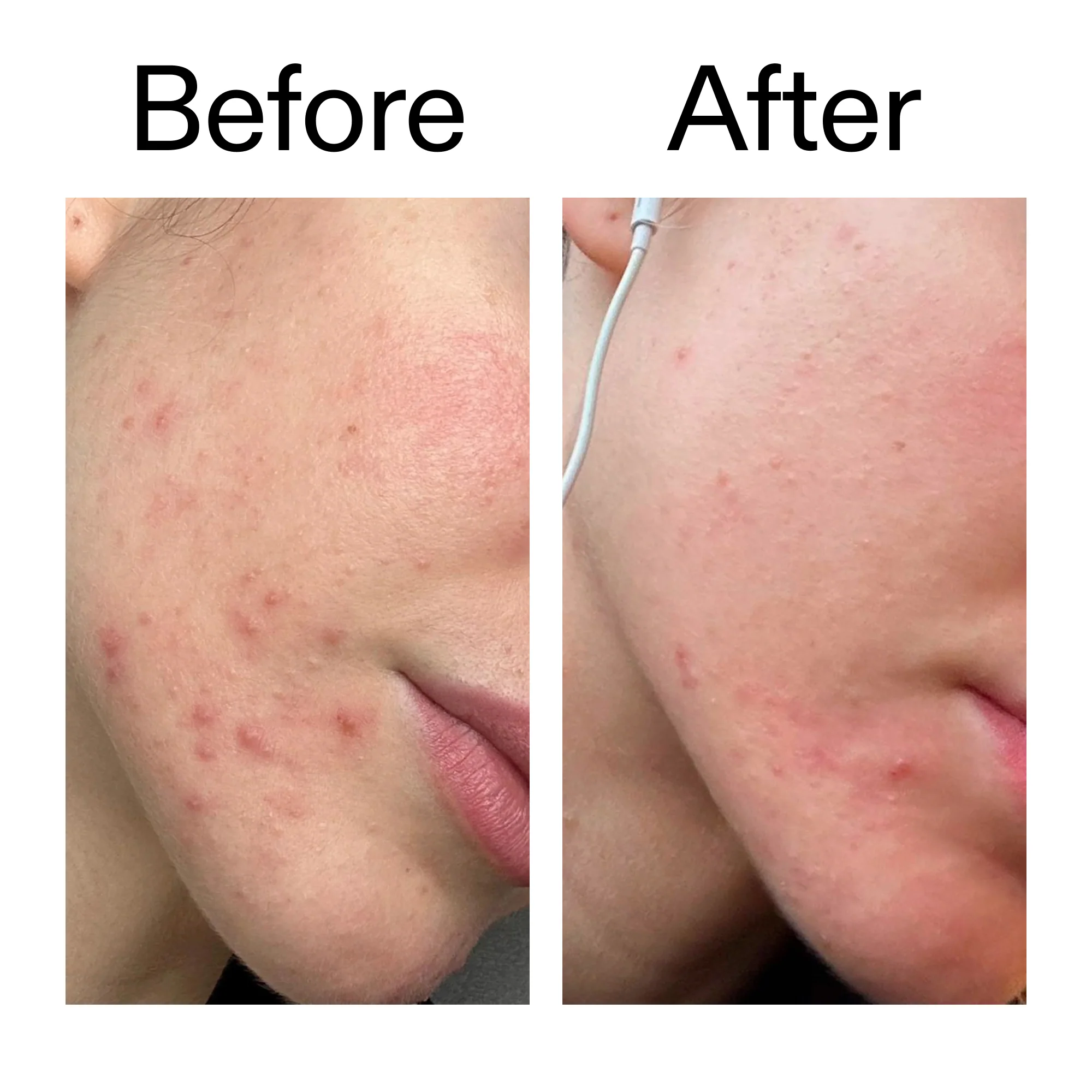 Blemish Clearing Moisturizer with 2% Novoretin - Image 11