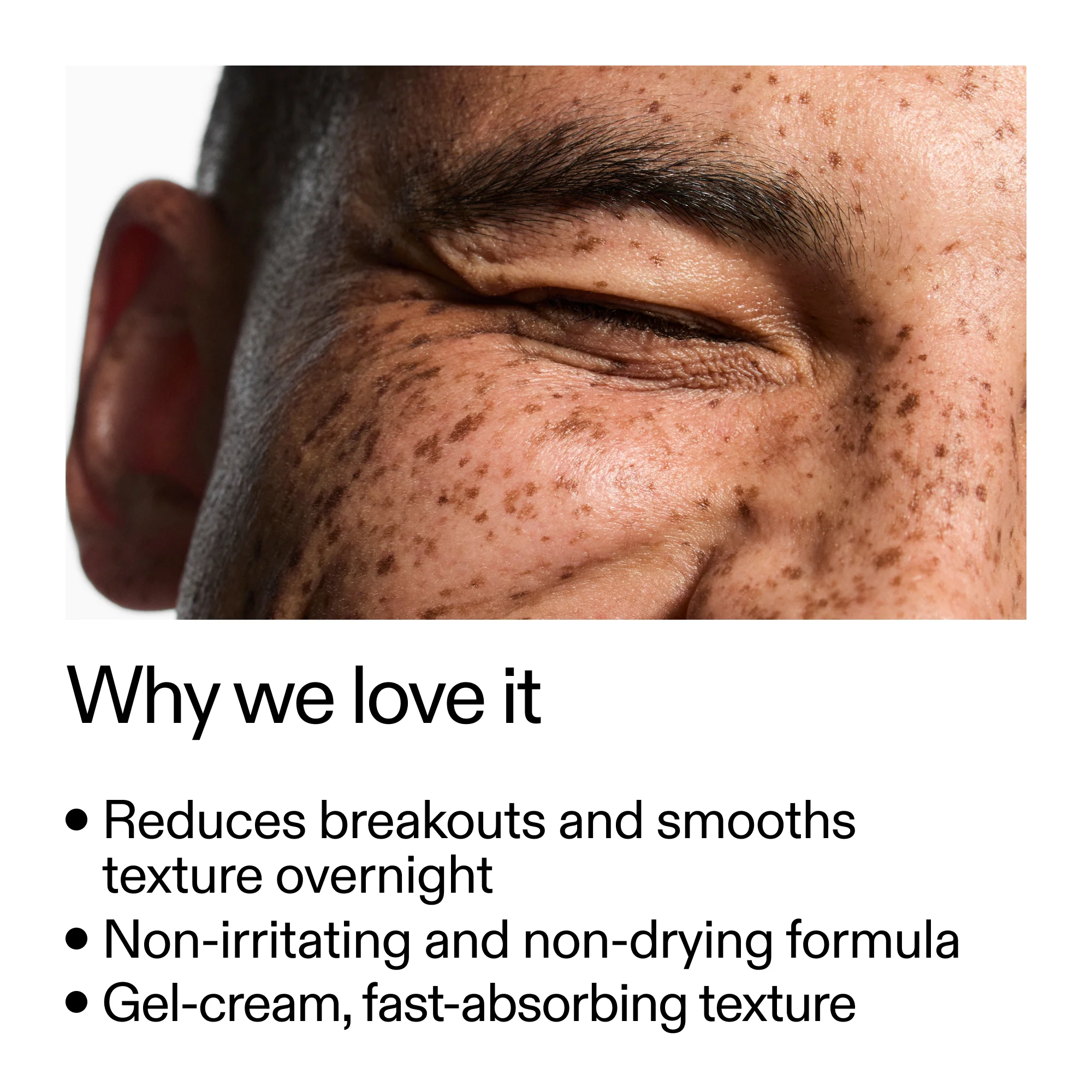 Blemish Clearing Moisturizer with 2% Novoretin - Image 4