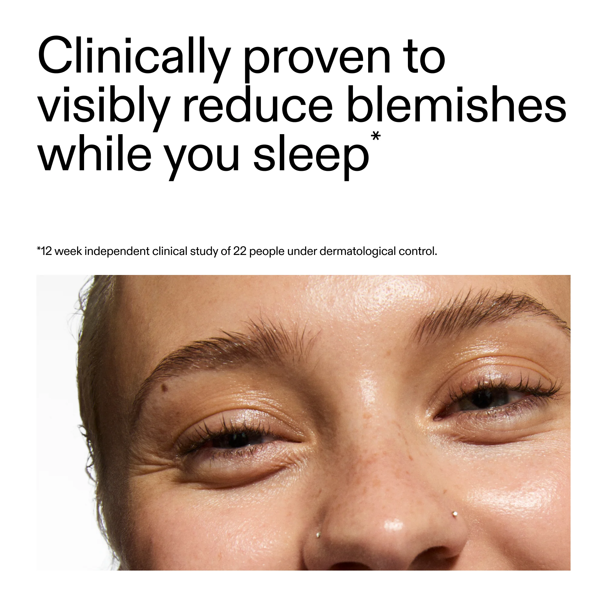 Blemish Clearing Moisturizer with 2% Novoretin - Image 5