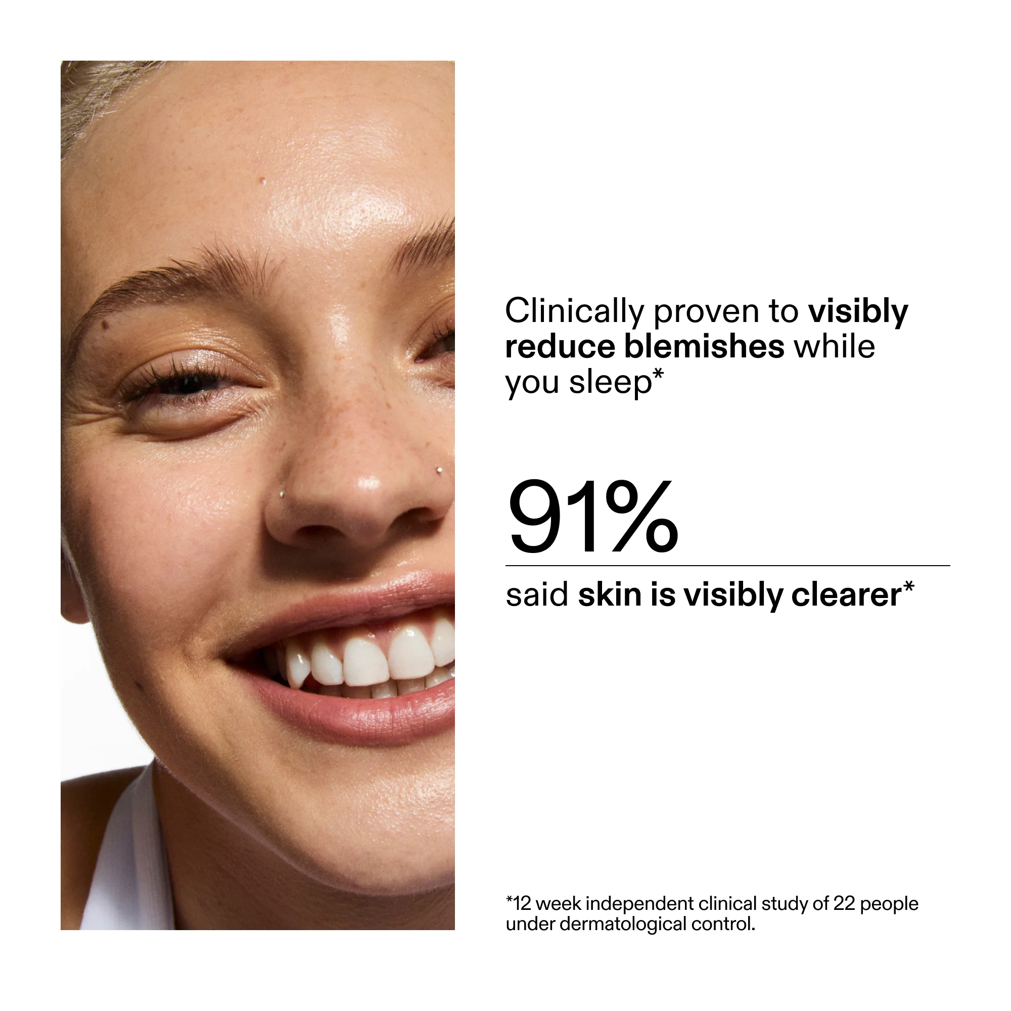 Blemish Clearing Moisturizer with 2% Novoretin - Image 7