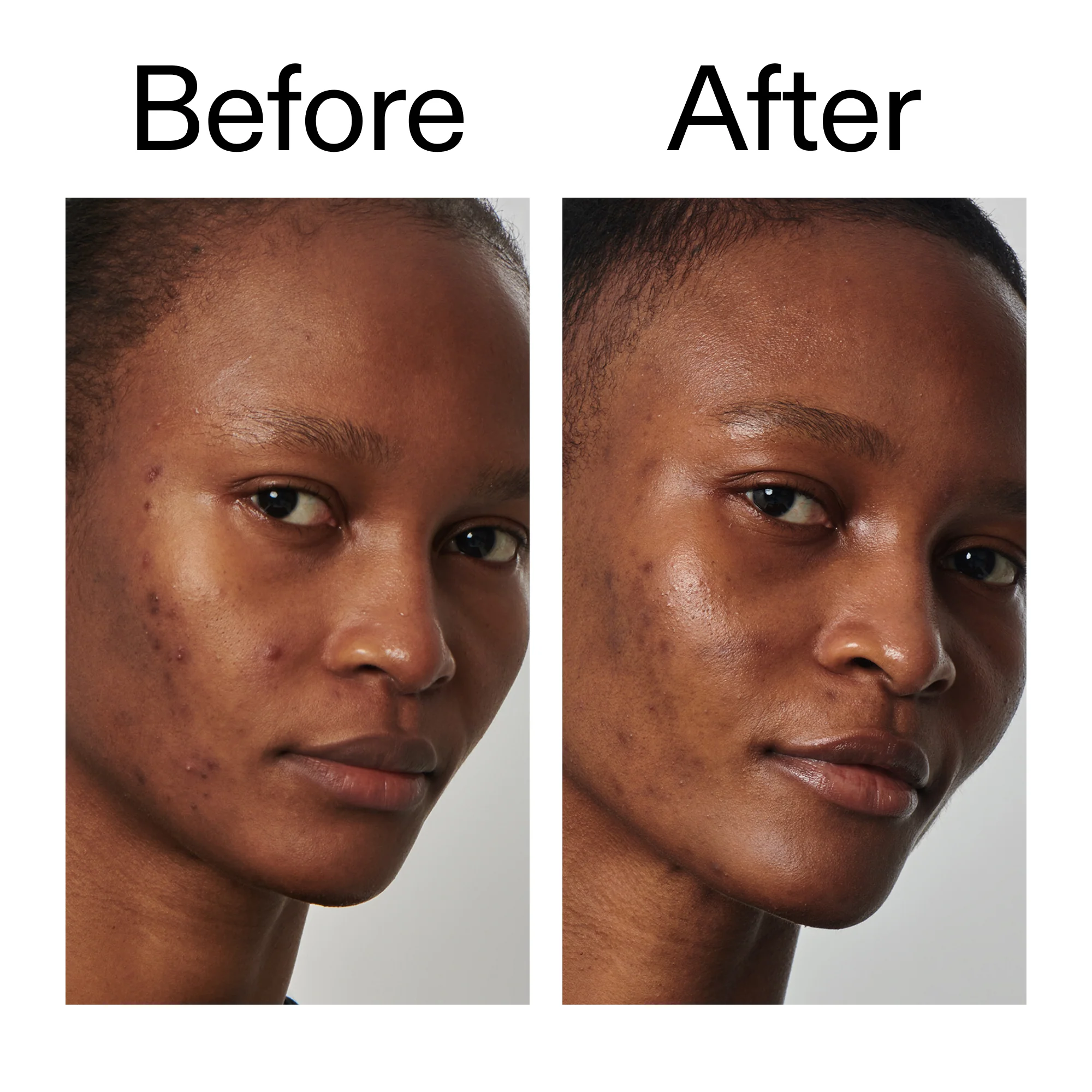 20% Niacinamide Serum - Image 10