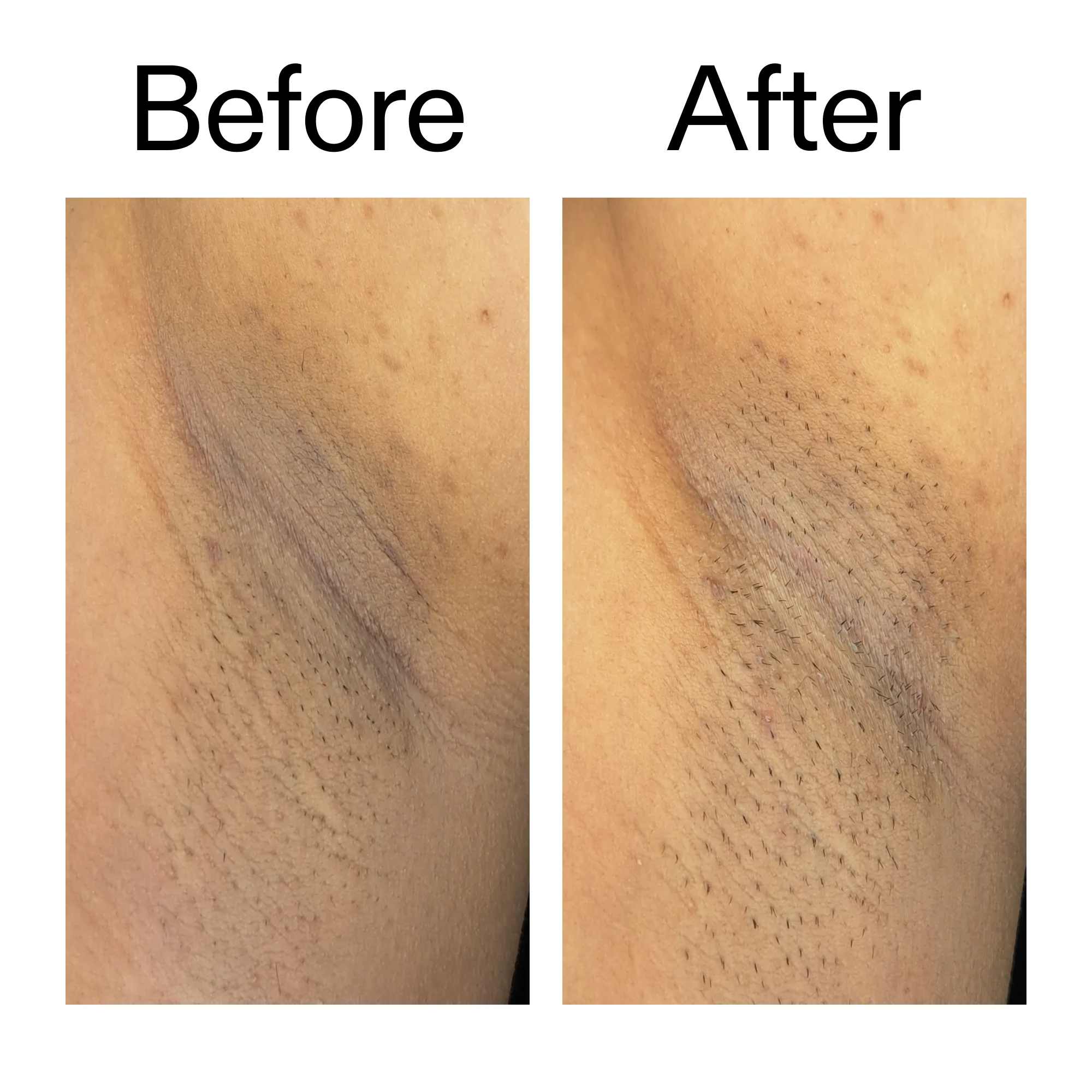 Glycolic Acid Exfoliating Body Stick Duo - Image 11