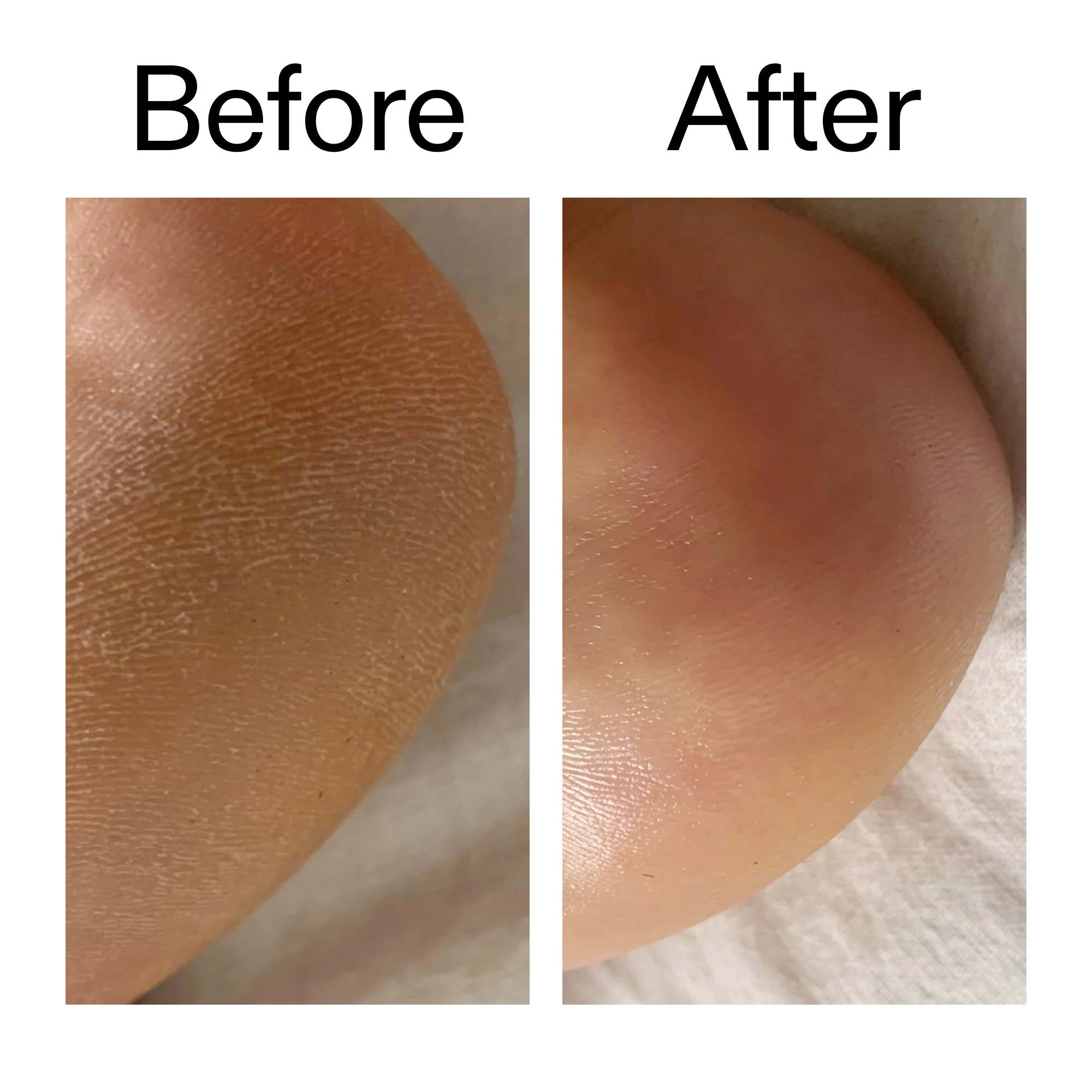 Glycolic Acid Exfoliating Body Stick Duo - Image 13