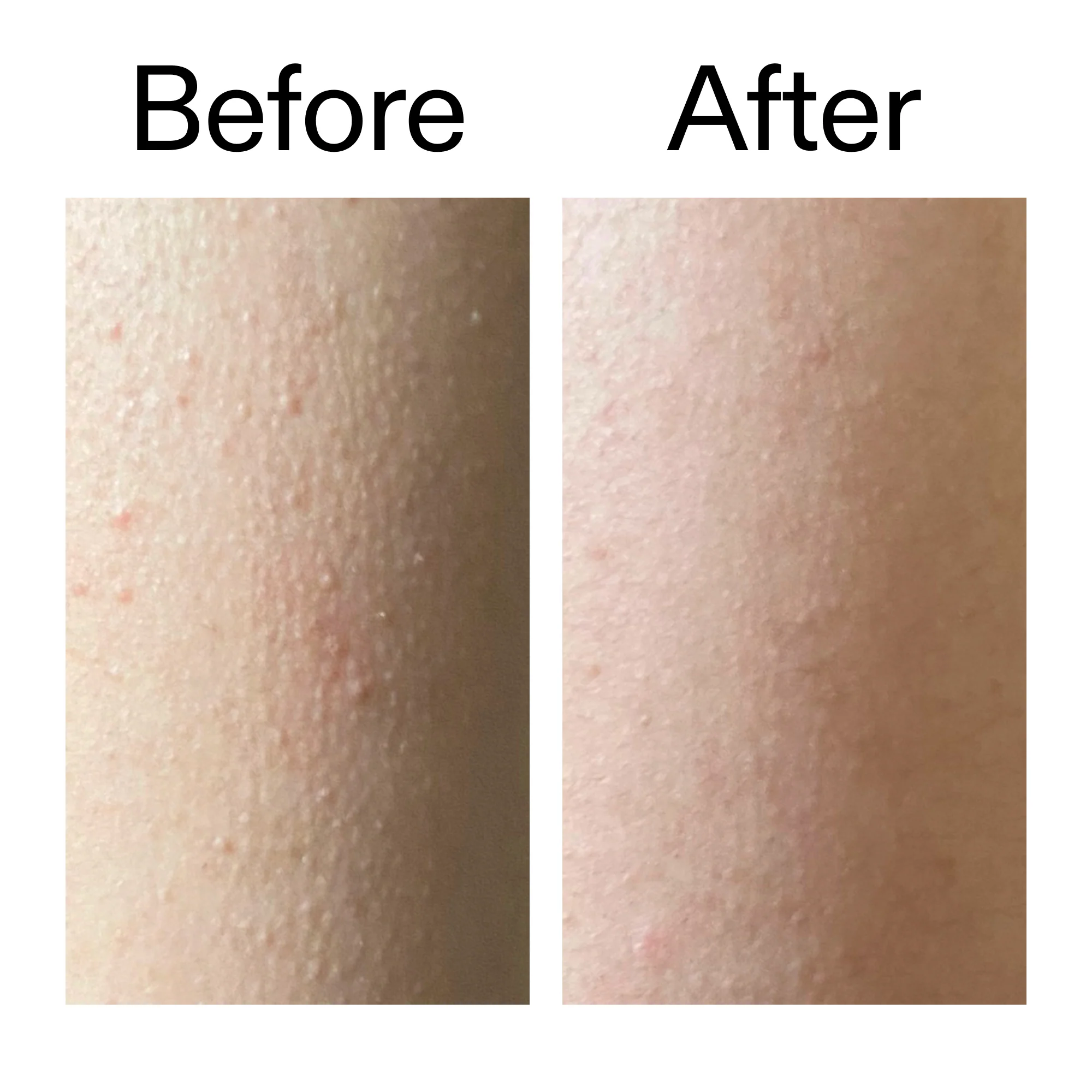 Glycolic Acid Exfoliating Body Stick Duo - Image 9