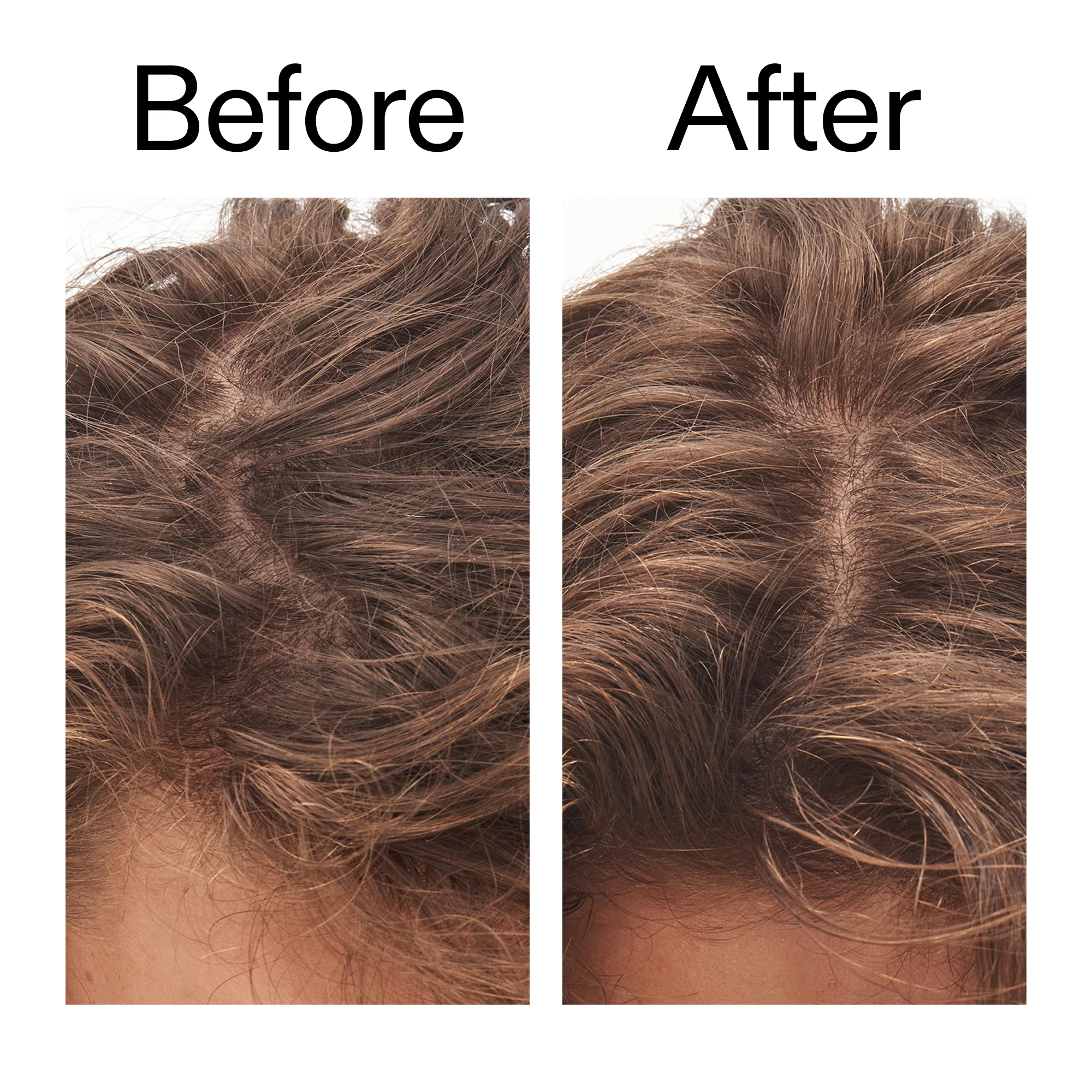 Glycolic Acid Exfoliating Scalp Scrub - Image 9