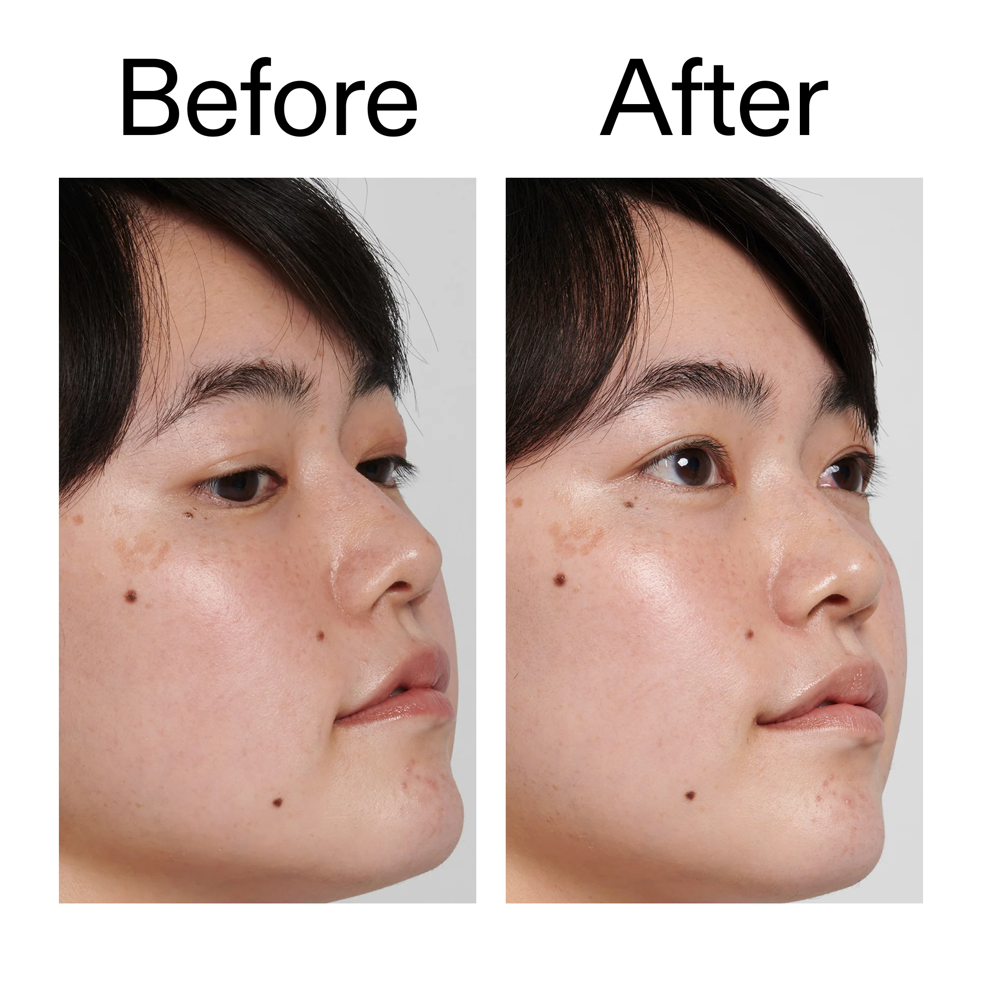 Hyaluronic Acid Cleanser - Image 10
