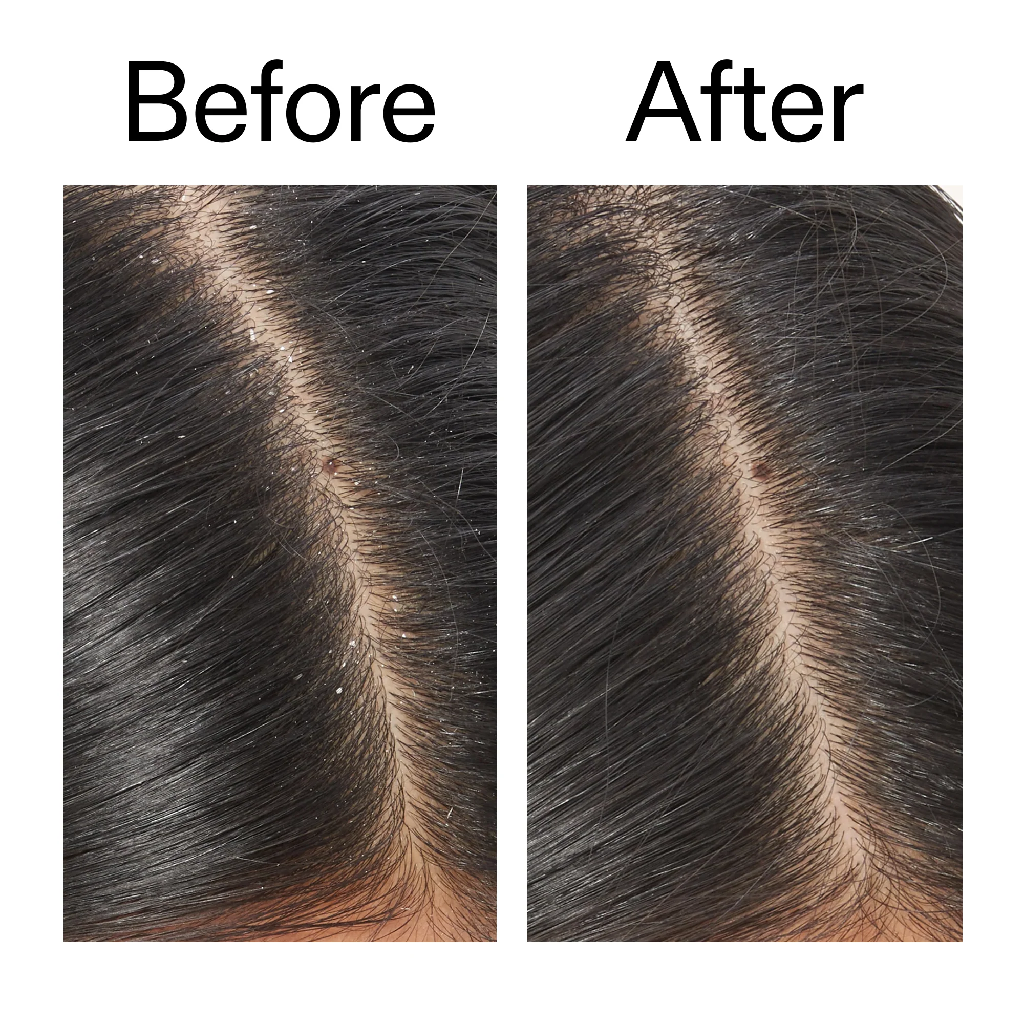 Salicylic Acid Exfoliating Scalp Treatment - Image 10